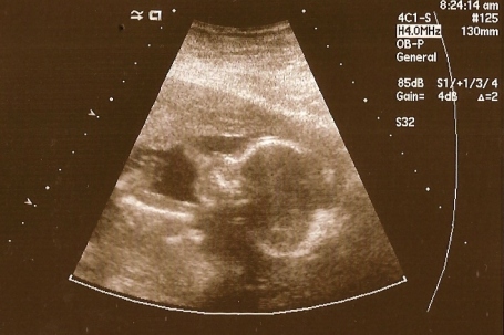 sydneys-ultrasound-001