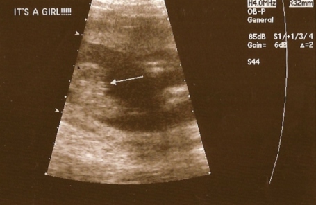 sydneys-ultrasound-002