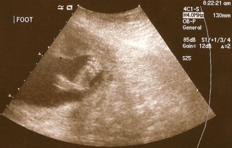 sydneys-ultrasound-003